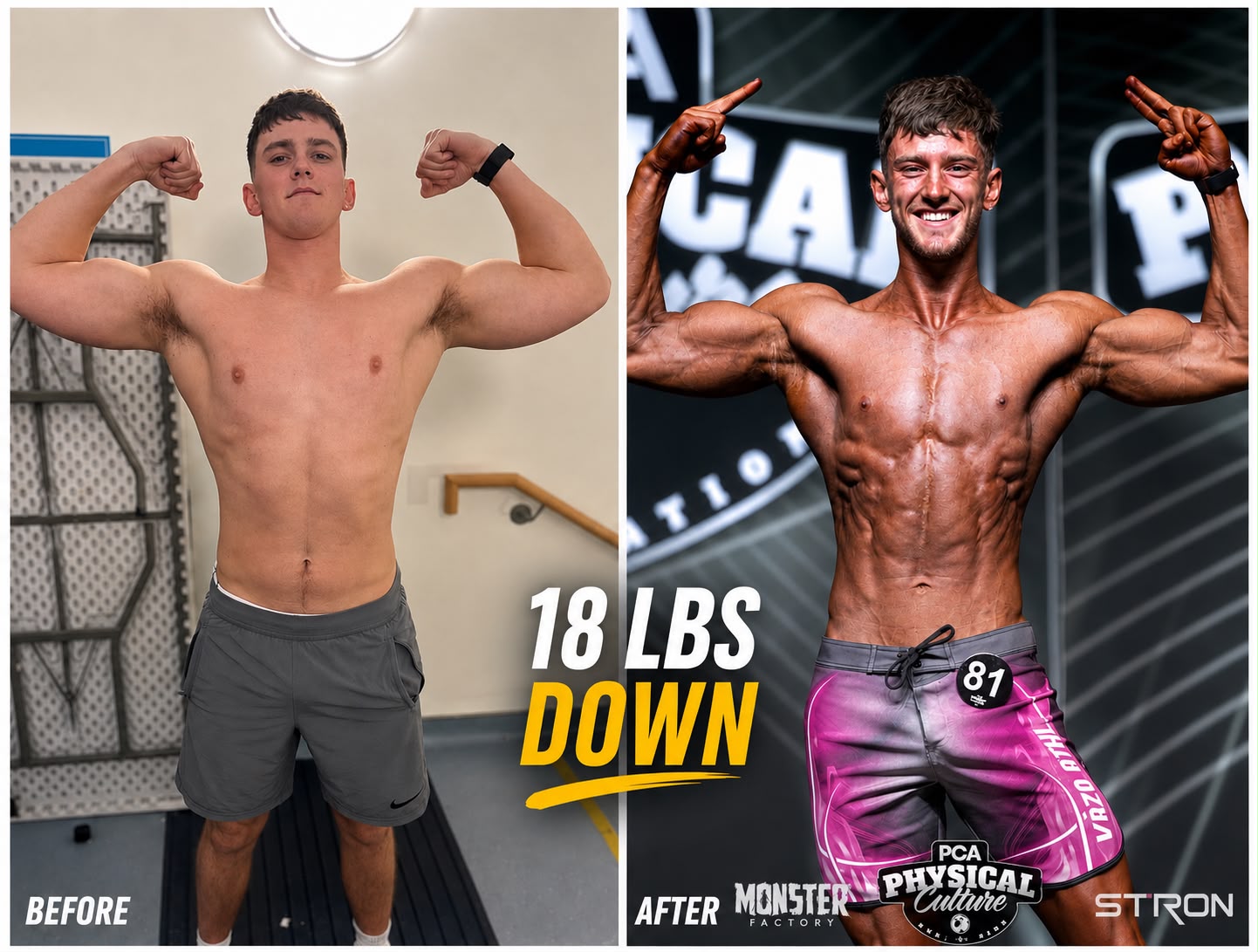 Legal Edge client: client progress photos